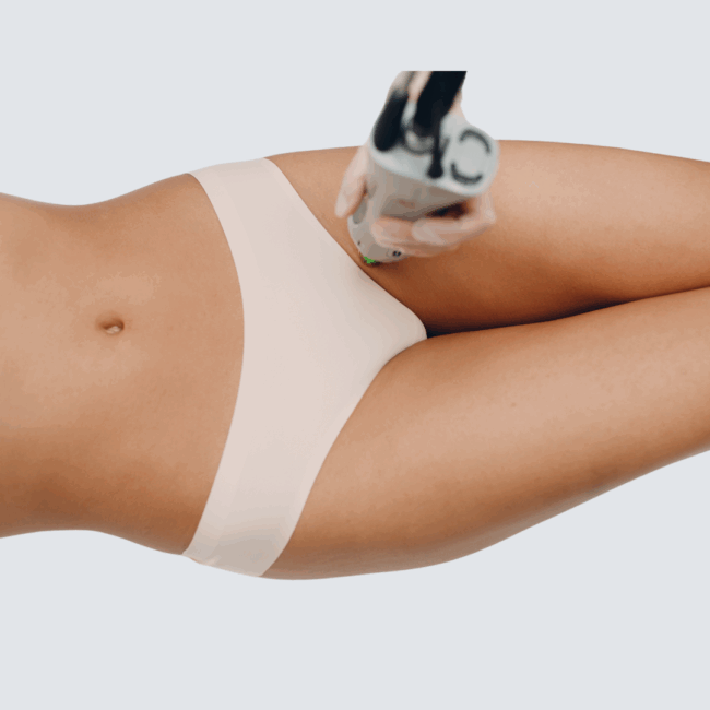 10 Legs, Bikini and Underarms Laser Hair Removal treatments