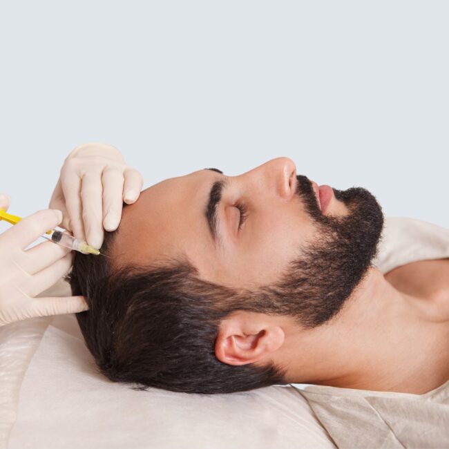 Scalp Mesotherapy