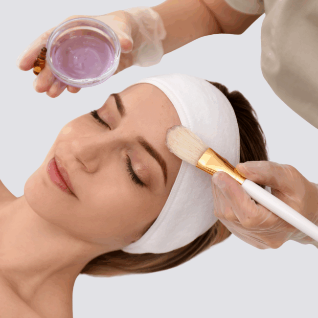 Superficial Peel